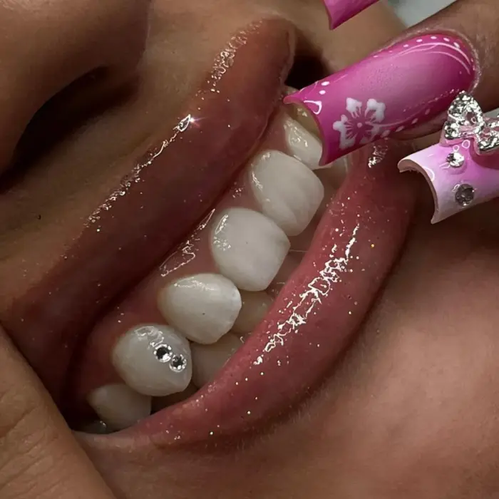 Nahaufnahme von glänzenden Lippen, weißen Zähnen mit kleinen Edelsteinen und rosa Nägeln mit Blumen- und Strassmustern.